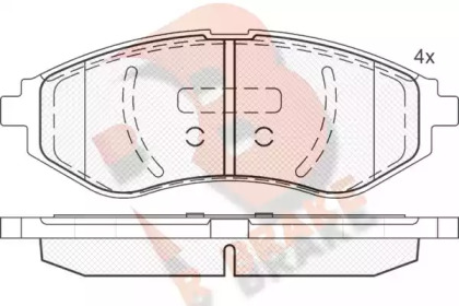 Комплект тормозных колодок RB1566 R BRAKE